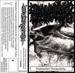 Brainspewer : Postmortem Thoracotomy to Determine the Cause of Death Brainspewer : Postmortem Thoracotomy to Determine the Cause of Death